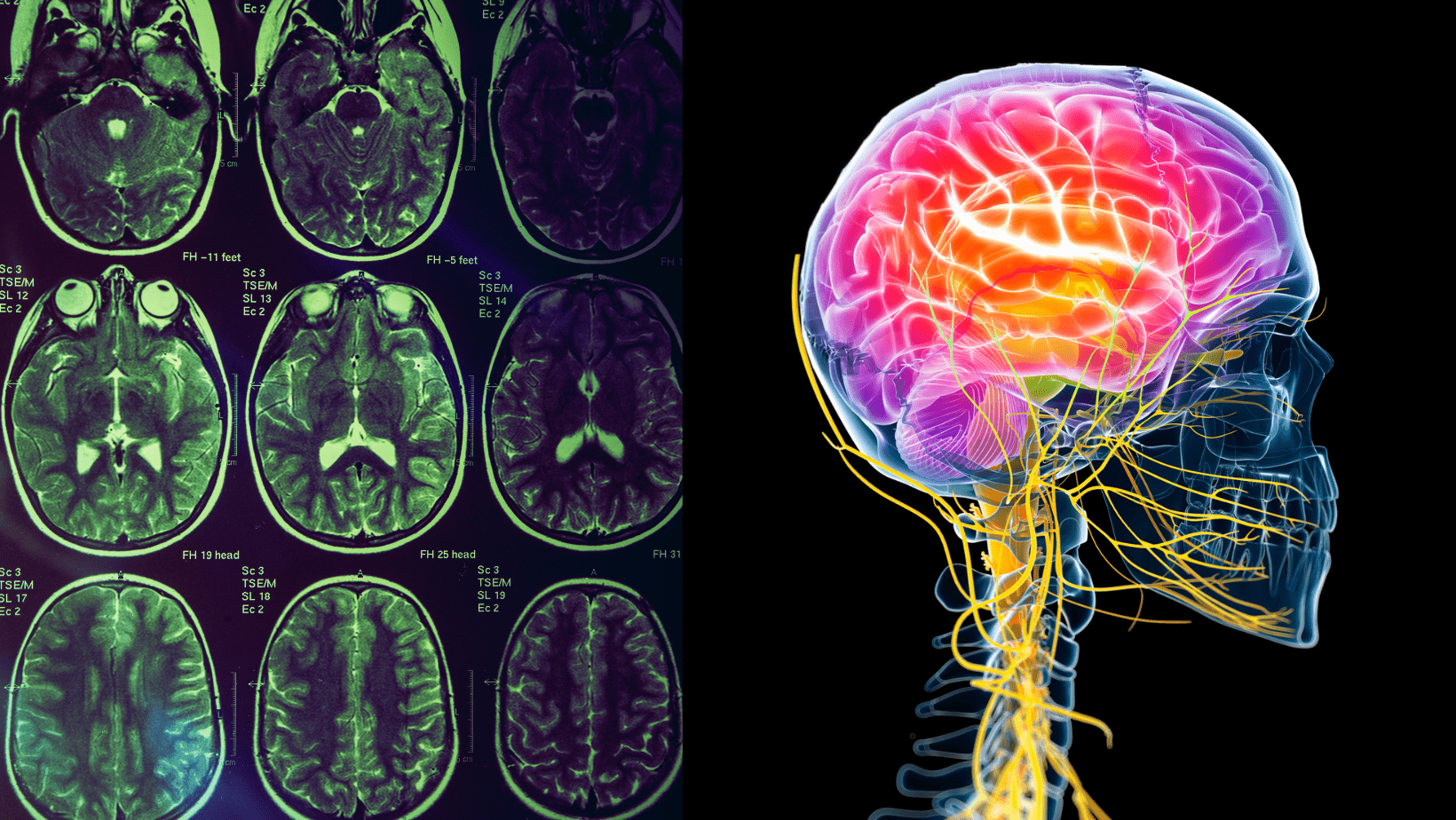 Le Più Comuni Malattie Neurologiche - Settimana Del Cervello